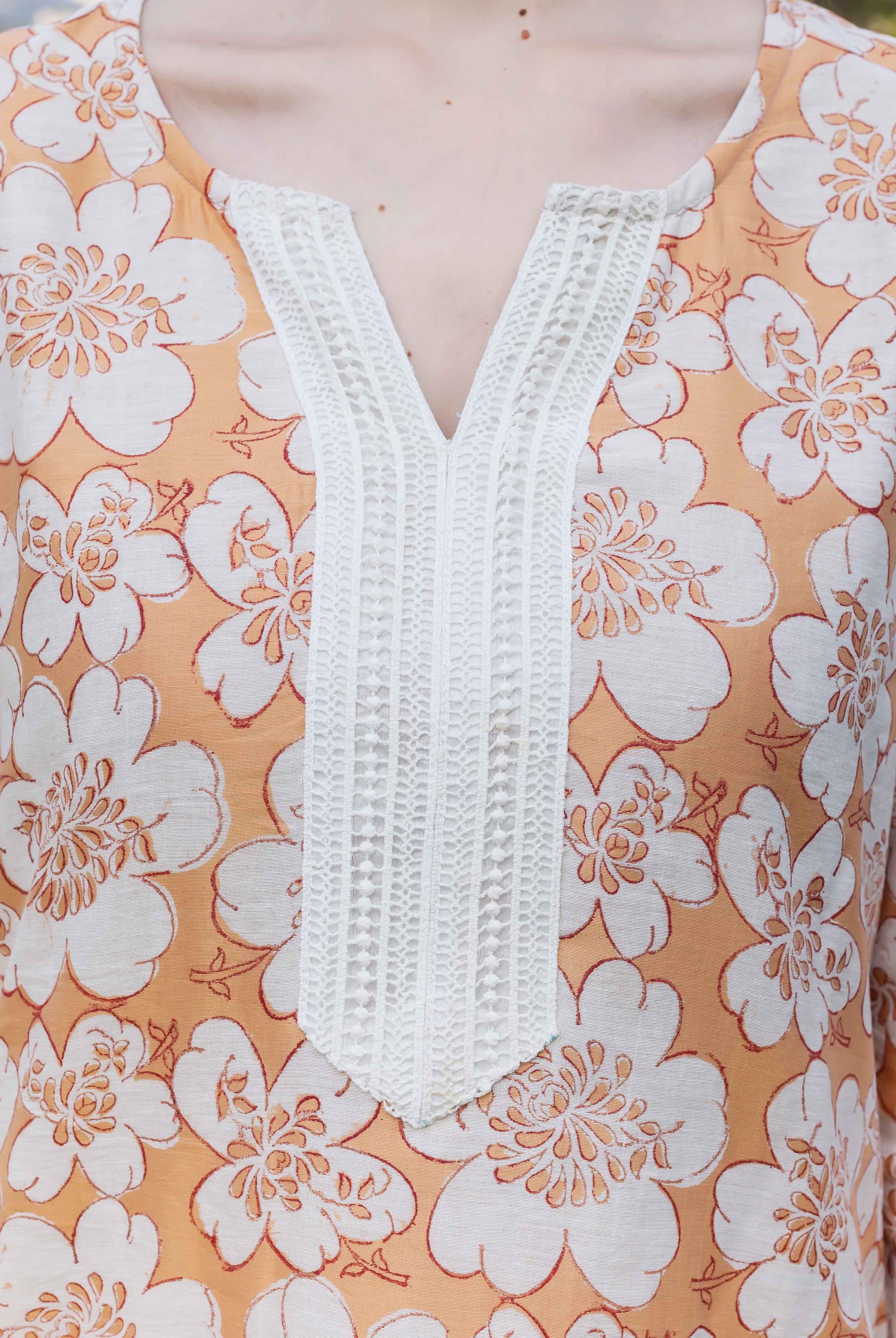 Close-up of model in golden yellow block-printed floral kurta with white lace V-neck.